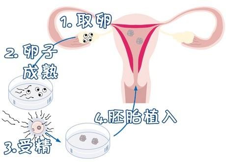 林教授